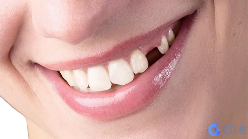 Chủ mơ dựa vào trải nghiệm để tìm ra rụng răng đánh số mấy Chủ mơ dựa vào trải nghiệm để tìm ra rụng răng đánh số mấy